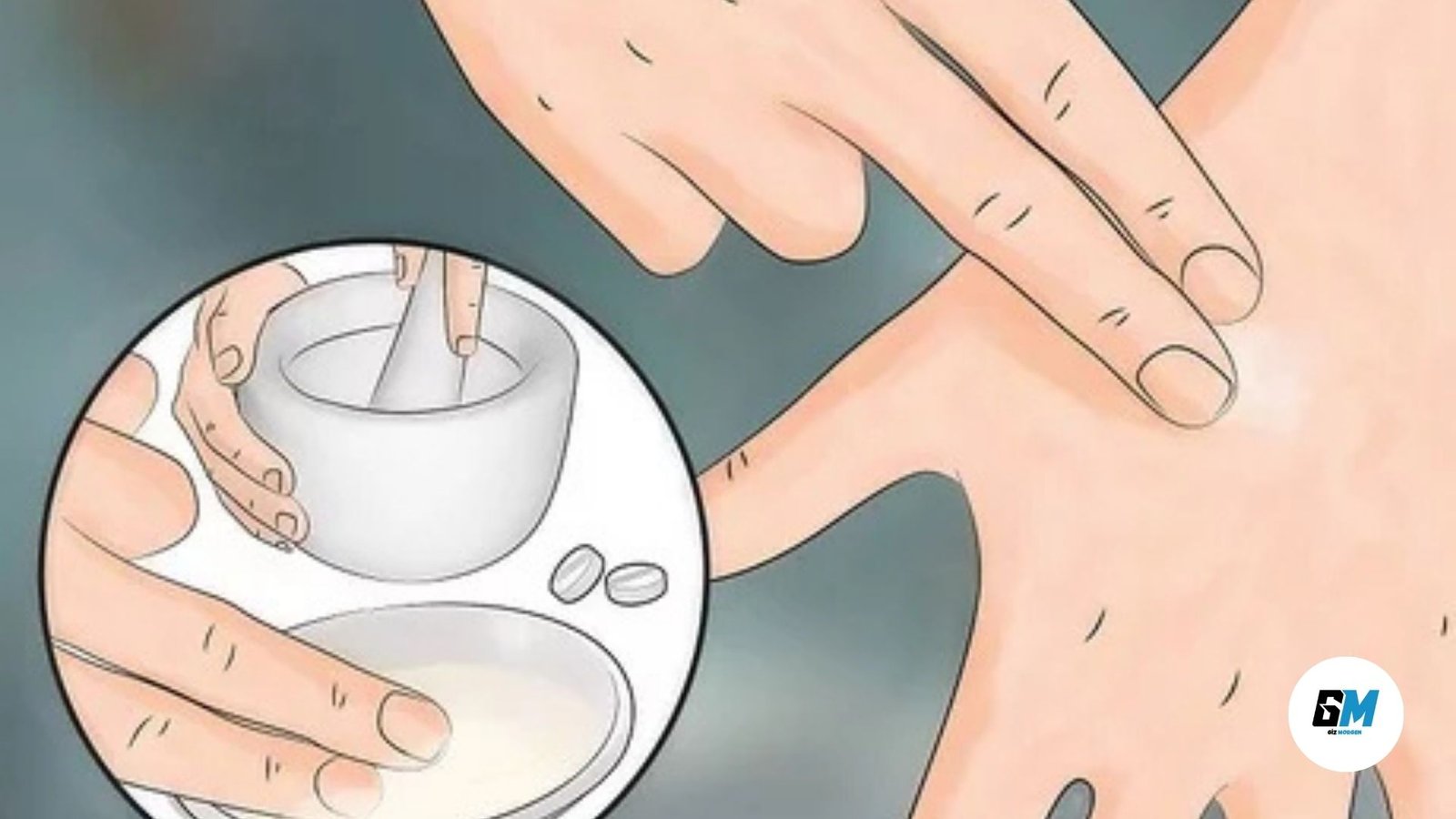 To Avoid Bitesolgemokz